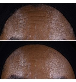 Smart Clinical Repair - Face + Neck Lifting Cream Smart Clinical Repair - Face + Neck Lifting Cream